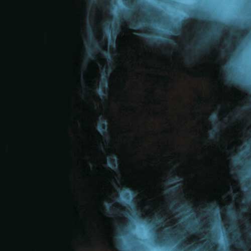 EA - II (CD)